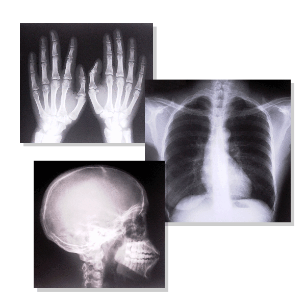 X-rays Credit: my-waste Team .